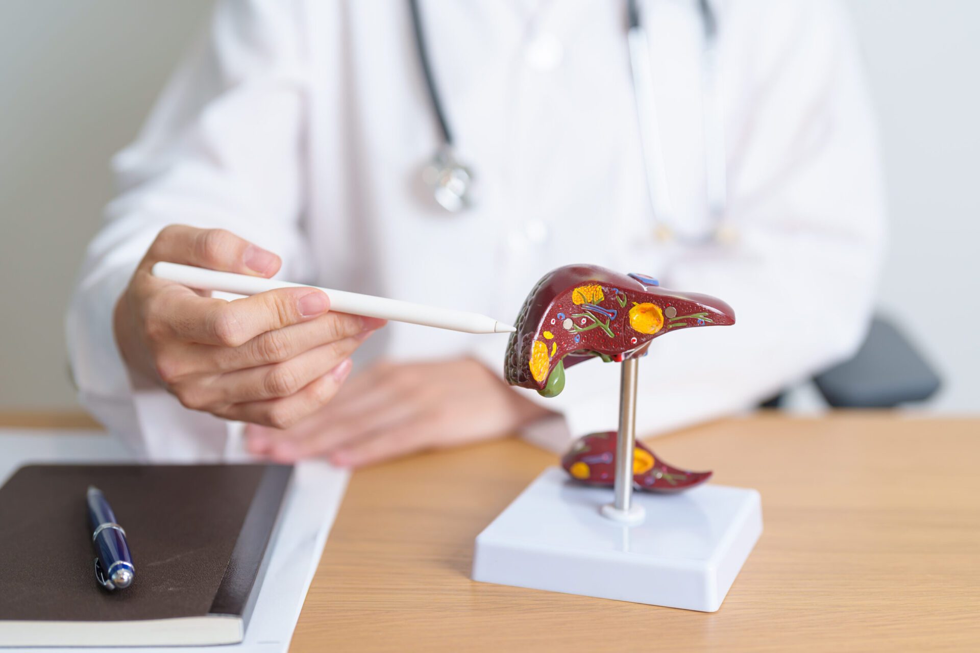 Doctor with human Liver anatomy model. Liver cancer and Tumor, J Dr. Ramsey Joudeh, MD treatment on procressing